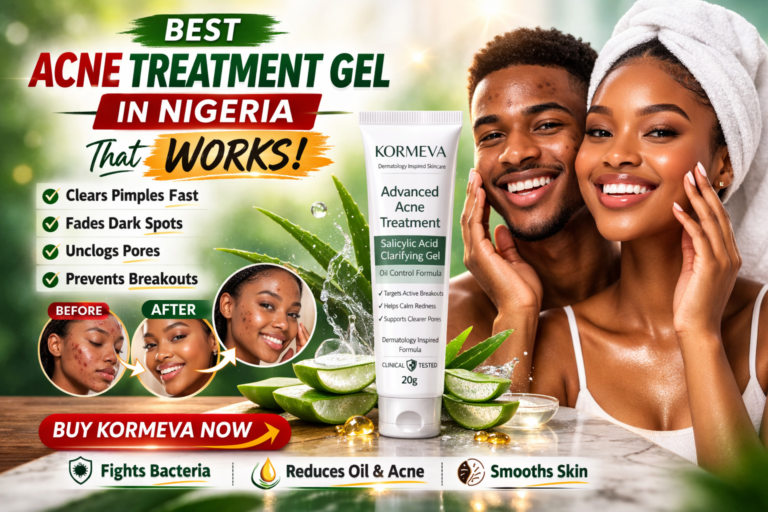 Acne Treatment Gel in Nigeria