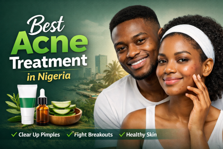 Best Acne Treatment in Nigeria