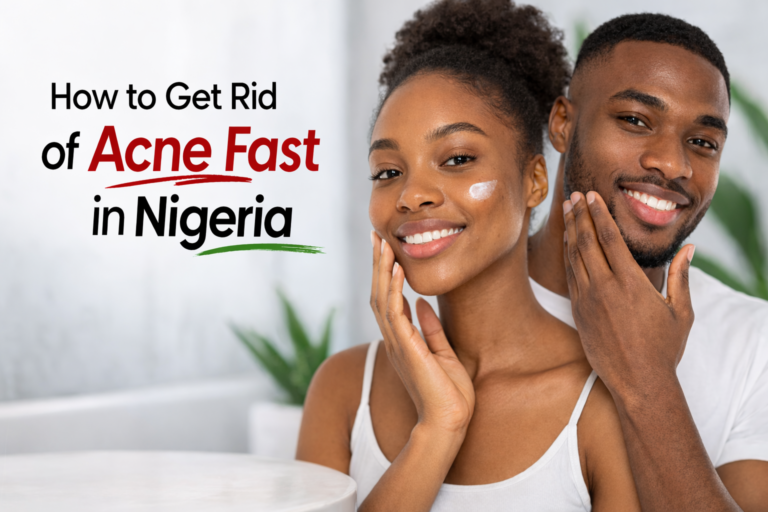How to Get Rid of Acne Fast in Nigeria